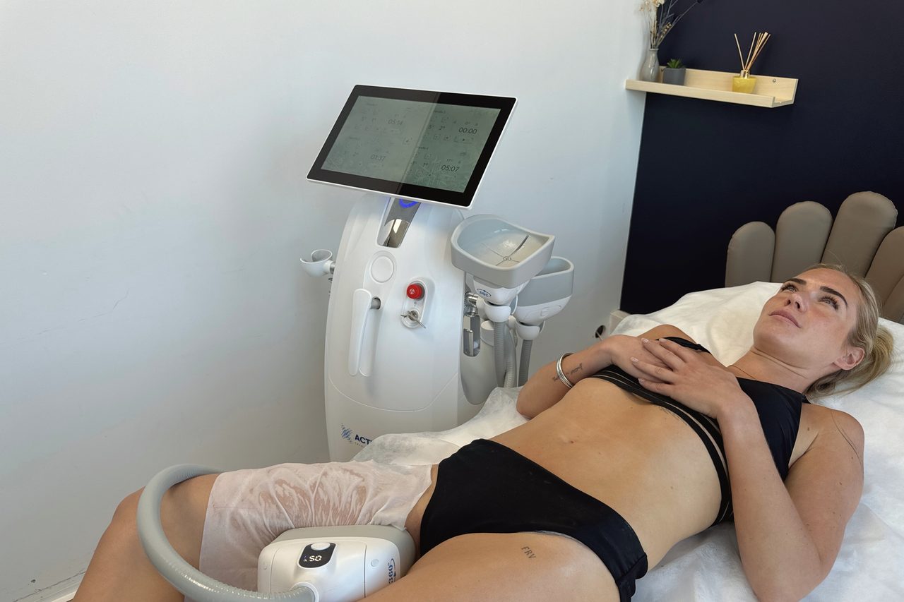 Machine Activ Ice cryolipolyse en cabinet — patiente sur table de soin
